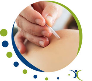 Myofascial Trigger Point Injections - Omni Spine Pain Management in Texas