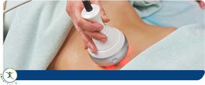 Radiofrequency Nerve Ablation Therapy in Mesquite, and Frisco, TX Radiofrequency Nerve Ablation Therapy in Mesquite, and Frisco, TX