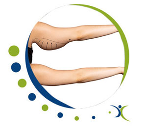 Lipo C “Skinny” Shot - Omni Spine Pain Management in Texas