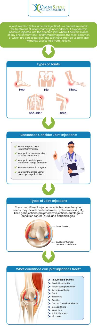 OmniSpine Pain Management specializes in Viscosupplementation Joint Injections for patients suffering from osteoarthritis. Some common symptoms of osteoarthritis include pain, stiffness, tenderness, loss of flexibility, grating sensations, bone spurs, and swelling. For more information, contact us today or book an appointment online. Our clinics are located in Frisco, TX, Sunnyvale, TX, Mesquite, TX, and Sherman, TX. OmniSpine Pain Management specializes in Viscosupplementation Joint Injections for patients suffering from osteoarthritis. Some common symptoms of osteoarthritis include pain, stiffness, tenderness, loss of flexibility, grating sensations, bone spurs, and swelling. For more information, contact us today or book an appointment online. Our clinics are located in Frisco, TX, Sunnyvale, TX, Mesquite, TX, and Sherman, TX.