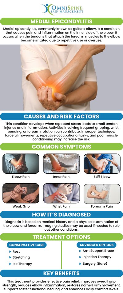 Medial epicondylitis is a disorder characterized by pain caused by inflammation that extends from the medial side of the elbow to the wrist. Dr. Andrew H. Morchower, M.D., M.P.H., provides proper diagnosis and treatment for medial epicondylitis at OmniSpine Pain Management. For more information, contact us or book an appointment online. We have convenient locations to serve you in Frisco, TX, Sunnyvale, TX and Mesquite, TX.